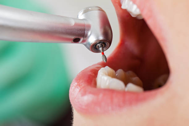 Best Emergency Dental Care for Sports Injuries in Reynoldsville, PA